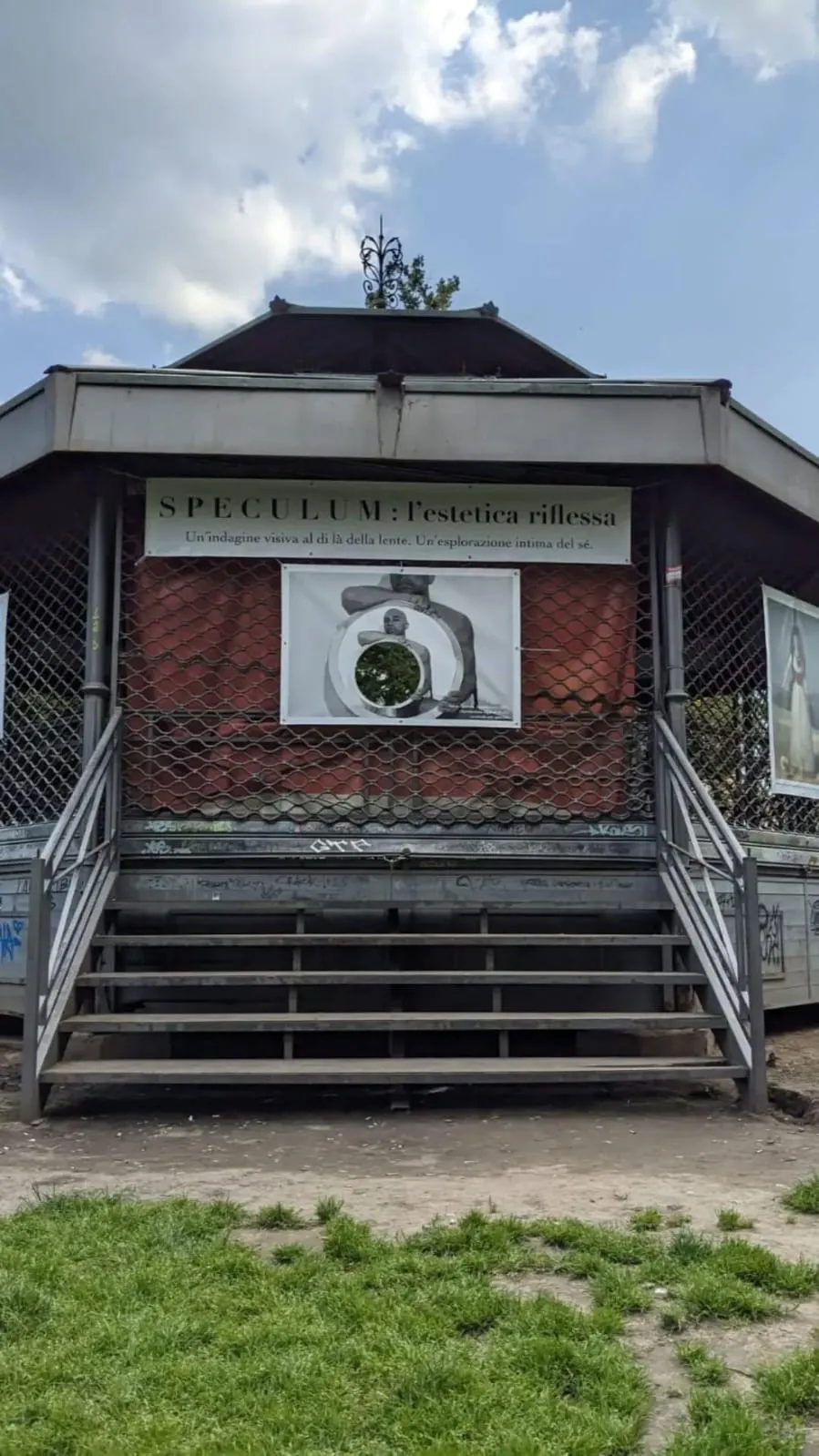 speculum